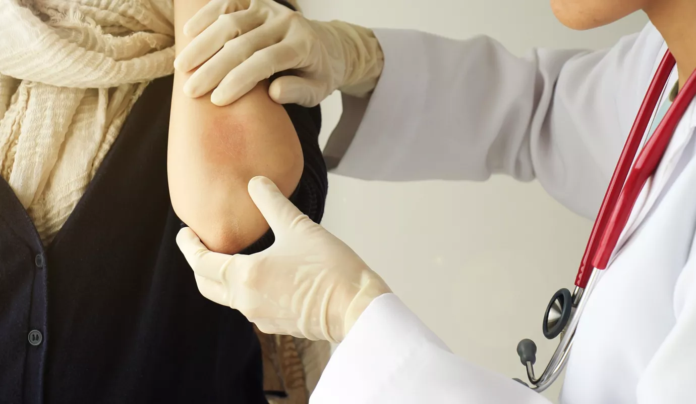 Adobe_Dermatologe_Psoriasis1